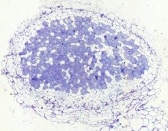 Light microscopy picture of <em>Lotus japonicus</em> nodule section infected with its natural symbiont <em>Mesorhizobium loti</em>.