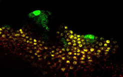 <p>Interspersed activity peaks of the indolic hormone auxin and the transcription factor CUP SHAPED COTYLEDON (CUC2) regulate serration pattern in <em>A. thaliana. </em>Confocal micrograph of developing leaf (side view) expressing an auxin activity reporter gene (<em>DR5::GFP</em>, in green) and a <em>CUC2 </em>reporter gene (<em>CUC2::CUC2:VENUS</em>, in yellow) at the margin of the A. thaliana leaf. <em>DR5</em> is a synthetic promoter that is responsive to the presence of auxin. Foci of <em>DR5</em> activity, and hence auxin activity, coincide with areas of down-regulation of <em>CUC2 </em>expression, and define the sites of serration formation.</p>
A computational model capturing regulatory interactions of CUC2 and auxin that produce this pattern has been developed and this helps conceptualize the process of leaf shape morphogenesis. The model was developed in collaboration with Prof. Prusinkiewicz in Calgary