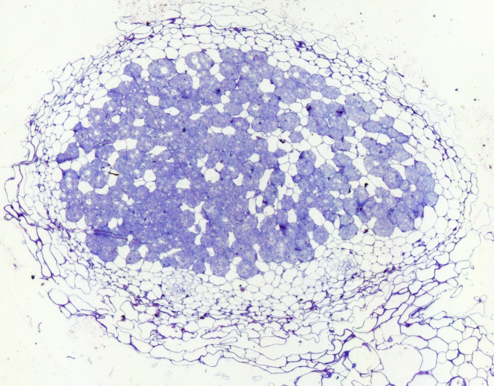 Light microscopy picture of <em>Lotus japonicus</em> nodule section infected with its natural symbiont <em>Mesorhizobium loti</em>.