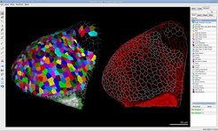 Screen shot of MorphoGraphX showing two consecutive time points of a tomato shoot meristem taken as confocal image stacks (from Kierzkowski et al. 2012). The curved surface shape is extracted, subdivided, and then segmented into cells, allowing the quantification of shape change at the cellular level. Initially developed as part of the SystemsX.ch Swiss initiative for systems biology Plant Growth RTD.
