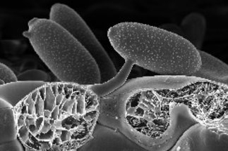 Innate Immunity and the Plant Microbiota (Paul Schulze-Lefert)