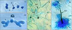 Figure 1. Conidia (C) germinating to form melanised appressoria (A). Figure 2. Appressorium (A) penetrating host epidermal cell to produce biotrophic primary hyphae (PH). Figure 3. Necrotrophic secondary hyphae (SH) emerging from biotrophic primary hyphae (PH). Figure 4. Acervuli on leaf surface, comprising conidia (C), conidiophores (Co) and melanised setae (S).