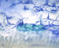 Die mikroskopische Aufnahme zeigt verzweigte Pilzfäden (blau) des Mehltaupilzes auf der Oberfäche eines Gersteblattes. Am oberen Rand der mittels einer speziellen Technik grünlich eingefärbten Zelle in der Bildmitte ist eine Bonbon-förmige Struktur, das pilzliche Haustorium, zu erkennen. Das Haustorium dient u.a. dem Ausschleusen von Effektorproteinen in die pflanzliche Wirtszelle.