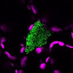 A colony of the bacterial pathogen Pseudomonas syringae (green) in an Arabidopsis thaliana leaf (magenta: plant structures called chloroplasts).