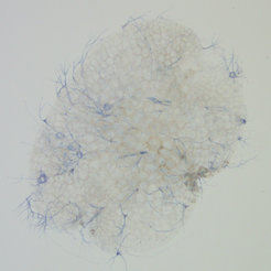 Marchantia infected with microbes