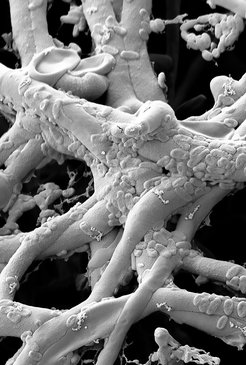 Figure 1. Electron microscopy image showing bacteria colonizing hyphae of root-colonizing fungi.