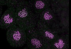 Figure 1: Meiocytes (cells that differentiate into gametes during meiosis) at prophase