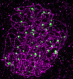 Foci marking crossover sites (green) on chromosomes (purple) at meiotic prophase