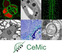 Louise Hughes: Volume electron microscopy in plant research